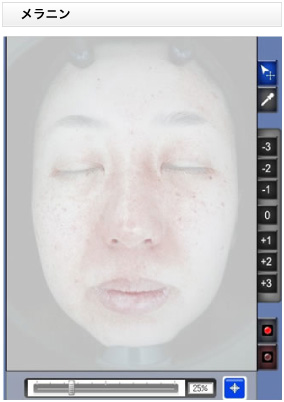 メラニン