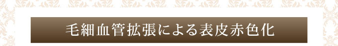 毛細血管拡張による表皮赤色変化
