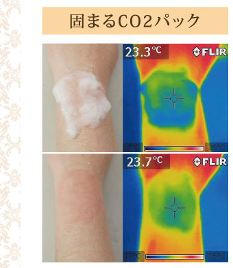 固まるCO2パック