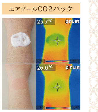 エアゾールCO2パック