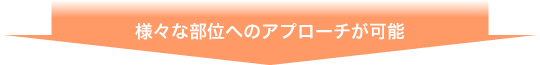 様々な部位へのアプローチが可能