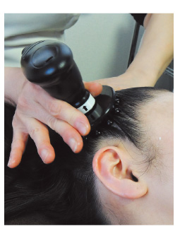頭皮の血行促進で薄毛のケアも