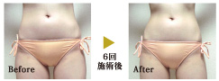 6回施術後の変化