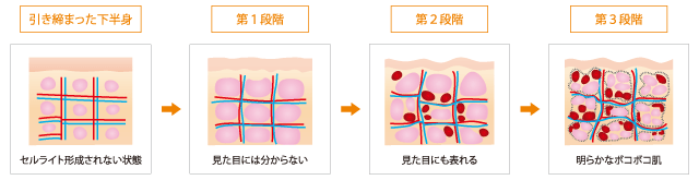 新規獲得・体感満足度No.1