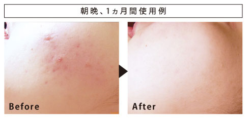 朝晩、1ヵ月間使用例